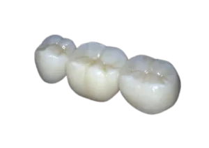 Crown-bridge