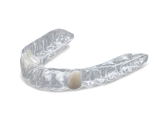 essix retainer
