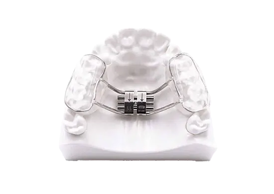 rapid-palatal-expander